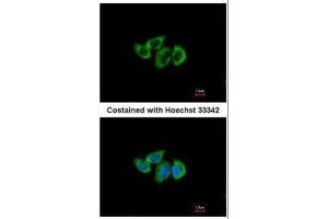 ICC/IF Image Immunofluorescence analysis of methanol-fixed A549, using RPL3, antibody at 1:500 dilution. (RPL3 抗体)