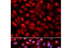 Immunofluorescence analysis of U2OS cells using PCBP2 Polyclonal Antibody (PCBP2 抗体)