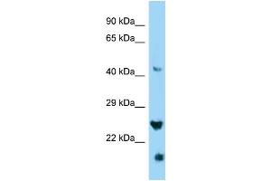 WB Suggested Anti-IZUMO4 Antibody Titration: 1. (IZUMO4 抗体  (C-Term))