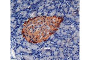 Used in DAB staining on fromalin fixed paraffin- embedded pancreas tissue (Cardiotrophin 1 抗体  (AA 1-203))