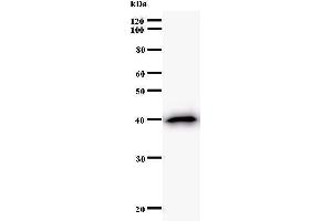Western Blotting (WB) image for anti-Small Nuclear RNA Activating Complex, Polypeptide 4, 190kDa (SNAPC4) antibody (ABIN930927) (SNAPC4 抗体)