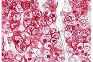 Immunohistochemistry (Paraffin-embedded Sections) (IHC (p)) image for anti-Solute Carrier Family 16, Member 12 (Monocarboxylic Acid Transporter 12) (SLC16A12) antibody (ABIN1449643)