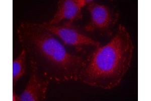 Immunofluorescence staining of methanol-fixed Hela cells using PLC-g1(phospho-Tyr771) Antibody. (Phospholipase C gamma 1 抗体  (pTyr771))