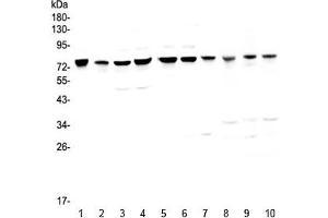 Western blot testing of human 1) HeLa, 2) placenta, 3) COLO-320, 4) HepG2, 5) PANC-1, 6) SGC-7901, 7) MBA-MD-231, 8) rat kidney, 9) mouse heart and 10) mouse kidney with PARN antibody at 0. (PARN 抗体)