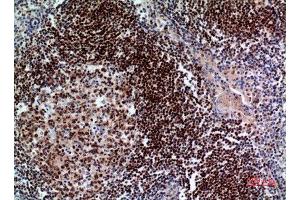 Immunohistochemistry (IHC) analysis of paraffin-embedded Human Tonsil, antibody was diluted at 1:100. (PAX5 抗体  (Internal Region))