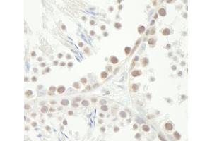 Immunohistochemistry (IHC) image for anti-Checkpoint Kinase 1 (CHEK1) (AA 250-300) antibody (ABIN7448476)