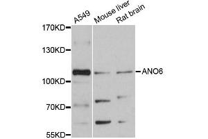 Western blot analysis of extracts of various cell lines, using ANO6 antibody (ABIN6291638) at 1:3000 dilution. (Anoctamin 6 抗体)