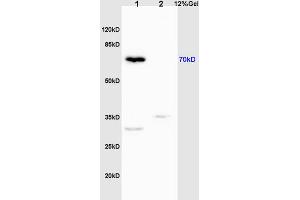 L1 mouse liver lysates L2 rat brain lysates probed with Anti Phospho-IRAK1 (Thr209) Polyclonal Antibody, Unconjugated (ABIN742658) at 1:200 overnight at 4 °C. (IRAK1 抗体  (pThr209))
