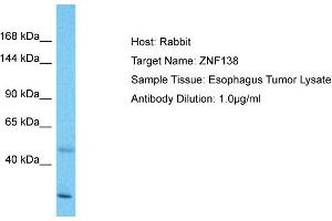 Host: Rabbit Target Name: ZNF138 Sample Type: Esophagus Tumor lysates Antibody Dilution: 1. (ZNF138 抗体  (Middle Region))