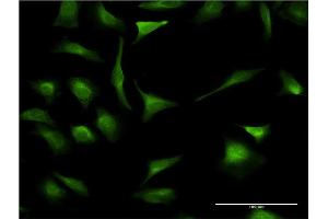 Immunofluorescence of monoclonal antibody to XBP1 on HeLa cell. (XBP1 抗体  (AA 123-225))