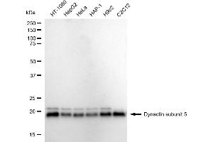 anti-Dynactin 1 (DCTN1) (Subunit 5) antibody