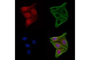 ABIN7094226 and ABIN7098273 staining Hela cells by IF/ICC. (FBXO7 抗体  (C-Term))