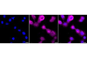 anti-Cytochrome B-245, beta Polypeptide (CYBB) antibody