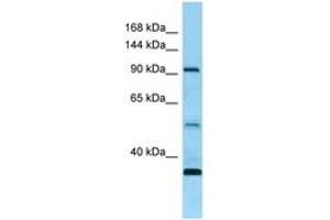 Image no. 1 for anti-Receptor Tyrosine Kinase-Like Orphan Receptor 1 (ROR1) (AA 155-204) antibody (ABIN6748473) (ROR1 抗体  (AA 155-204))