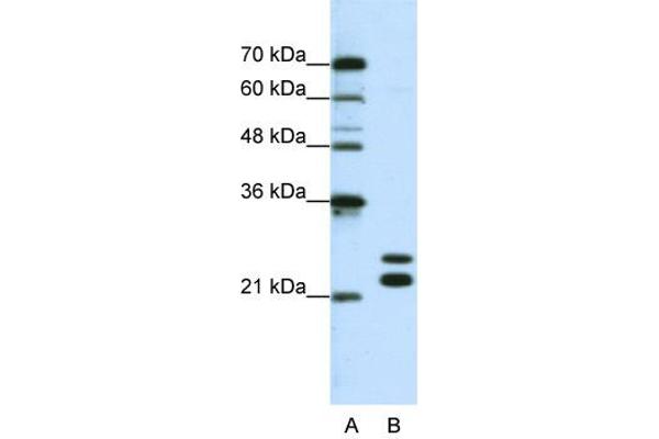 CSDC2 抗体  (N-Term)