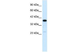 C4BPB antibody used at 1 ug/ml to detect target protein. (C4BPB 抗体  (N-Term))