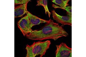 Immunofluorescence analysis of Hela cells using NEFL mouse mAb (green). (NEFL 抗体)