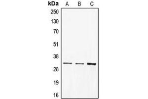Western blot analysis of CD40 expression in BJAB (A), A431 (B), Ramos (C) whole cell lysates.