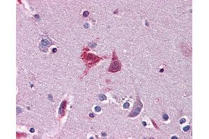 Anti-WDR20 antibody IHC of human brain, cortex. (WDR20 抗体  (AA 1-570))