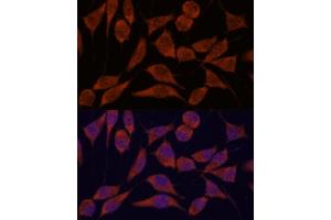 Immunofluorescence analysis of L929 cells using TRA antibody (ABIN7270871) at dilution of 1:100. (TRAPPC6A 抗体  (AA 1-173))