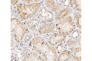 ABIN6266570 at 1/200 staining human kidney tissue sections by IHC-P. (KRT17 抗体  (C-Term))
