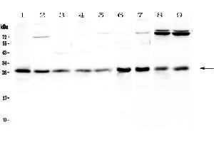 Western blot analysis of RAB27A using anti-RAB27A antibody .