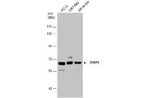 WB Image MMP2 antibody detects MMP2 protein by western blot analysis. (MMP2 抗体)