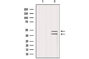 Western blot analysis of extracts from Hela, using SUGT1 Antibody. (SUGT1 抗体  (C-Term))