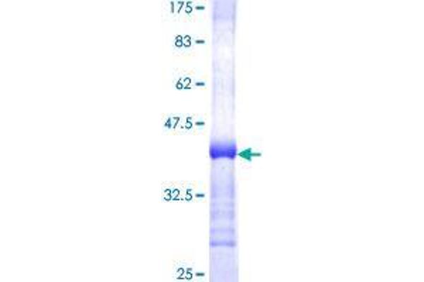 DDX19B Protein (AA 380-478) (GST tag)