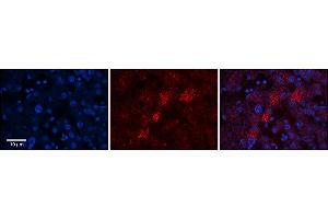 Rabbit Anti-C19orf10 Antibody  Catalog Number: ARP63969_P050 Formalin Fixed Paraffin Embedded Tissue: Human Adult Liver  Observed Staining: Cytoplasm in hepatocytes, moderate tissue distribution, resemble Golgi structures  Primary Antibody Concentration: 1:100 Secondary Antibody: Donkey anti-Rabbit-Cy3 Secondary Antibody Concentration: 1:200 Magnification: 20X Exposure Time: 0. (C19orf10 抗体  (Middle Region))