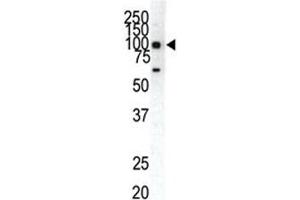 Western blot analysis of EphA1 antibody and HeLa cell lysate. (EPHA1 抗体  (AA 913-943))