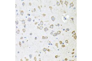 Immunohistochemistry of paraffin-embedded mouse brain using  antibody (ABIN6129179, ABIN6136708, ABIN6136710 and ABIN6222176) at dilution of 1:100 (40x lens). (AKAP5 抗体  (AA 1-270))