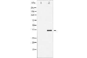 Western blot analysis of I kappaB beta phosphorylation expression in TNF-a treated 293 whole cell lysates,The lane on the left is treated with the antigen-specific peptide.