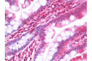 Immunohistochemistry (IHC) image for anti-Cytochrome P450, Family 2, Subfamily F, Polypeptide 1 (CYP2F1) (AA 55-326) antibody (ABIN1960168)