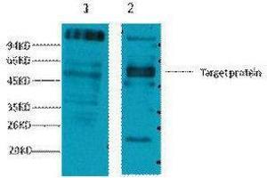 Western Blotting (WB) image for anti-Fc Fragment of IgE, Low Affinity II, Receptor For (CD23) (FCER2) antibody (ABIN3178635) (FCER2 抗体)