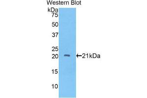 Western Blotting (WB) image for anti-ADAM Metallopeptidase with thrombospondin Type 1 Motif, 12 (ADAMTS12) (AA 827-1001) antibody (ABIN1857901) (ADAMTS12 抗体  (AA 827-1001))