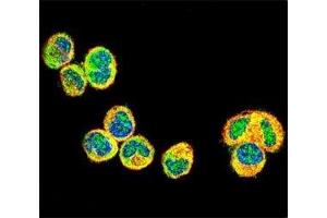 IF testing of AKT1 antibody with MDA-MB435 cells followed by Alexa Fluor 488-conjugated goat anti-rabbit lgG (green). (AKT1 抗体  (AA 115-144))