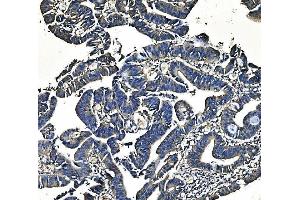 IHC analysis of PCK2 using anti-PCK2 antibody (ABIN7599509). (PEPCK 抗体  (AA 1-640))