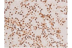 ABIN6267523 at 1/200 staining Rat kidney tissue sections by IHC-P. (SYK 抗体  (pTyr348))