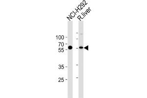 Western Blotting (WB) image for anti-Methylcrotonoyl-CoA Carboxylase 2 (Beta) (MCCC2) antibody (ABIN3002883) (MCCC2 抗体)