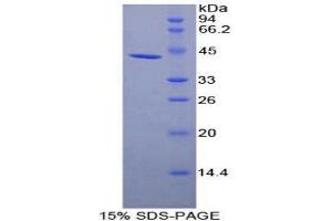 SDS-PAGE (SDS) image for Plasminogen Activator, Urokinase Receptor (PLAUR) (AA 221-305) protein (His tag,GST tag) (ABIN1171121) (PLAUR Protein (AA 221-305) (His tag,GST tag))