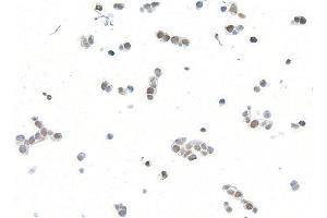 Immunocytochemistry (ICC) image for anti-Bloom Syndrome RecQ Like Helicase (BLM) (C-Term) antibody (ABIN7795726) (Recombinant BLM 抗体  (C-Term))