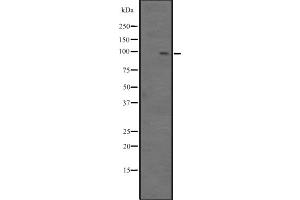 Western blot analysis of BCL11B expression in Jurkat cell lysate,The lane on the left is treated with the antigen-specific peptide. (BCL11B 抗体  (Internal Region))