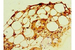 Immunohistochemistry of paraffin-embedded human trachea tissue using ABIN7168119 at dilution of 1:100 (POP7 抗体  (AA 1-140))