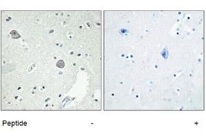 Immunohistochemical analysis of paraffin-embedded Human-Brian , antibody was diluted at 1:100. (D1DR 抗体  (Internal Region))
