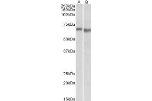 Western Blotting (WB) image for anti-Protein Kinase, AMP-Activated, alpha 2 Catalytic Subunit (PRKAA2) (Internal Region) antibody (ABIN571224)