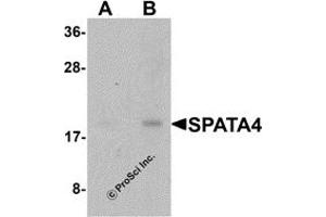 Western Blotting (WB) image for anti-Spermatogenesis Associated Protein 4 (SPATA4) (C-Term) antibody (ABIN1077367) (SPATA4 抗体  (C-Term))