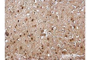 IHC-P Image SKP1 antibody detects SKP1 protein at cytosol and nucleus on mouse middle brain by immunohistochemical analysis. (SKP1 抗体)