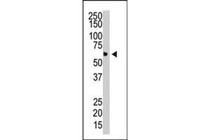 The PIAS4 polyclonal antibody  is used in Western blot to detect PIAS4 in HL-60 cell lysate. (PIAS4 抗体  (N-Term))
