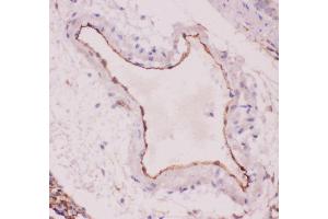 Anti-ACE Picoband antibody,  IHC(P): Rat Lung Tissue
